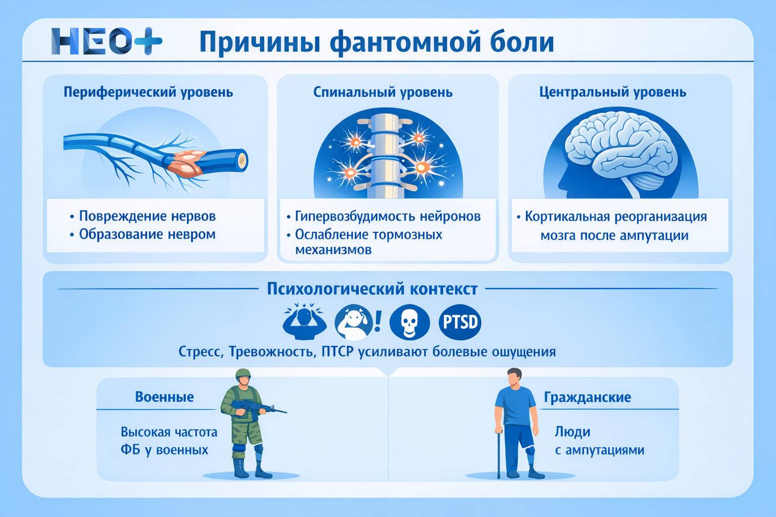 Причины фантомной боли инфогарфика